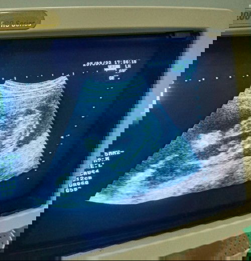 น้องเป็น ช หรือ ญ คะ
แม่ๆช่วยดูให้หน่อยค่ะ