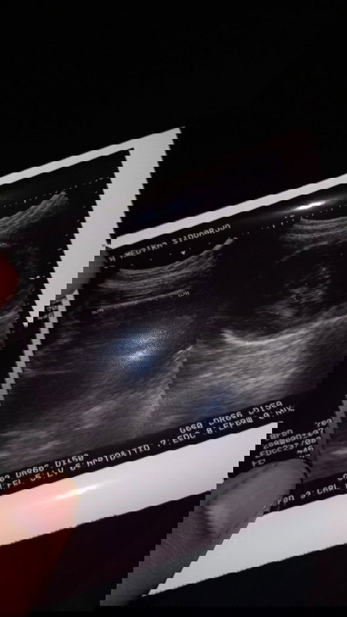 Mohon dijelaskan bunda , terimakasih 🥰