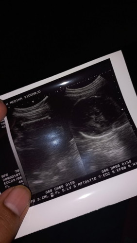 Mohon dijelaskan bunda , terimakasih 🥰