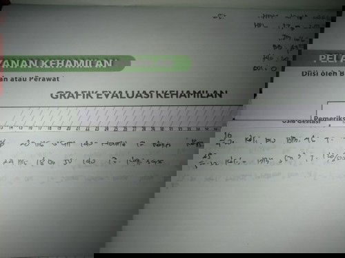 Usia kehamilan Hasil USG dan pemeriksaan Bidan berbeda