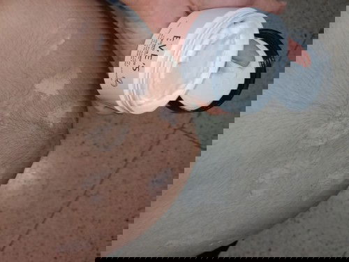 ครีมดีๆแก้ท้องแตกลาย