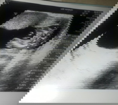 แม่ๆช่วยดูหน่อยค่ะว่าผู้ ญ/ช