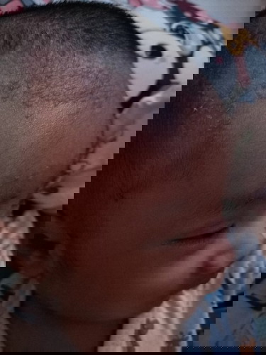 Biar cepat hilang pakai apa ya bund?