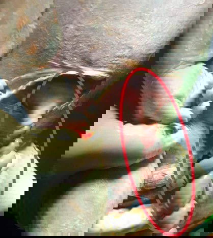 Cord Accident happened to my supposed to be first baby! (2019)