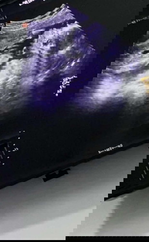 แบบนี้ ญ หรือ ช น้า