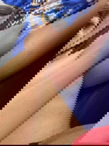 ถามแม่ๆค่ะใครมีประสบการณ์แบบนี้บ้าง