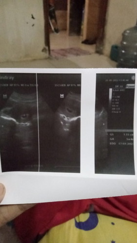 Serius bertanya
