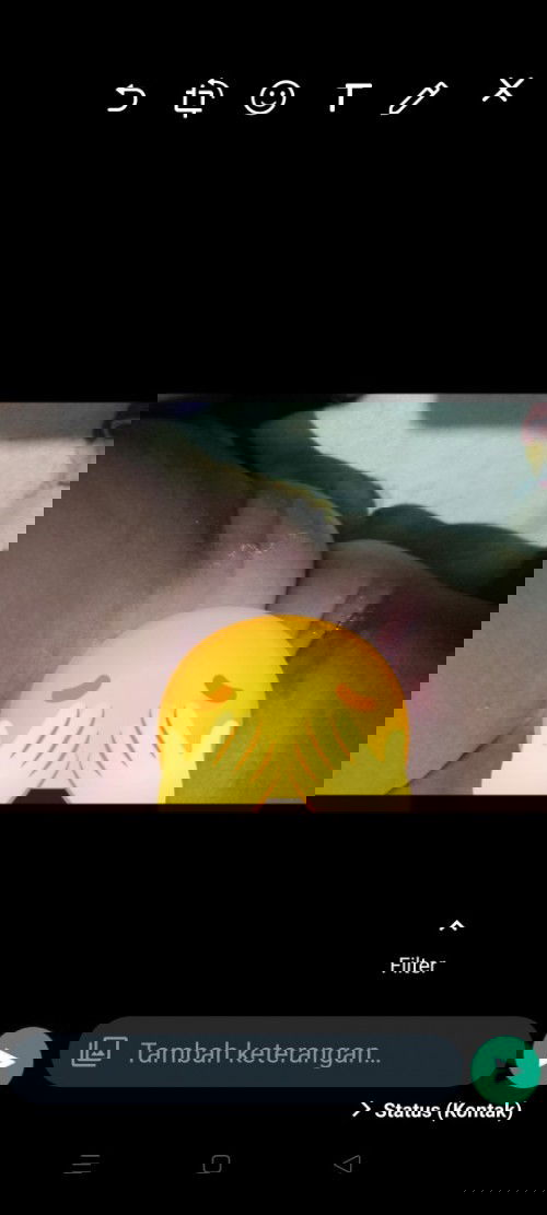 Merah" di slakangan anak