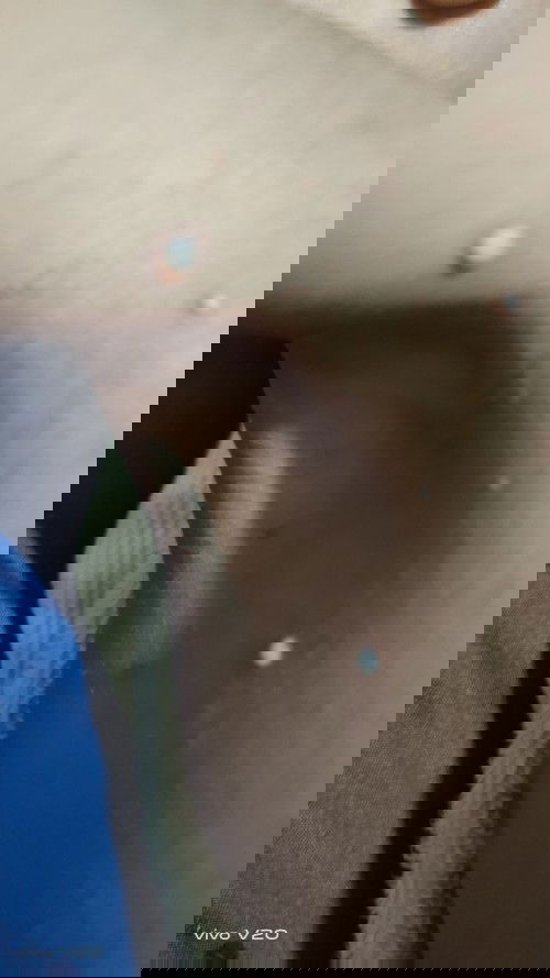 Kaya cacar tapi bukan cacar