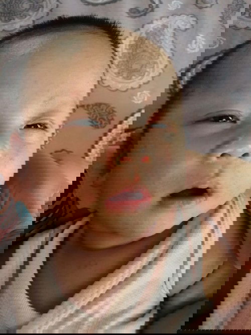 แม่คนไหนเคยเจอลูกมีผื่นแดงขึ้นตามหน้ากับลำตัวบางคะช่วยแนะนำหน่อยค่ะ