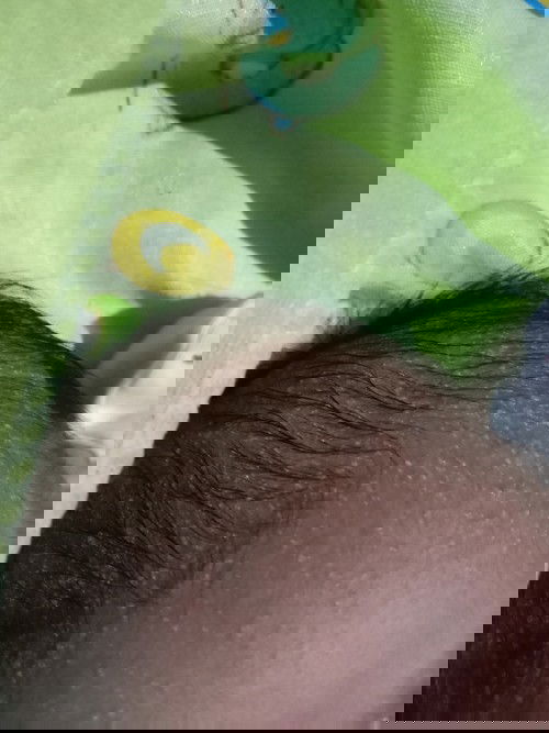 Bintik berair di area kepala