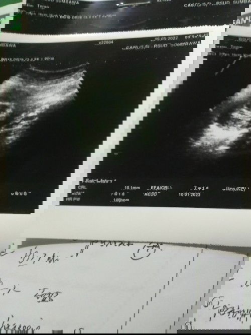 hamil 7 mgg keluar darah (haid)