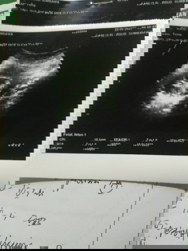 hamil 7 mgg keluar darah (haid)