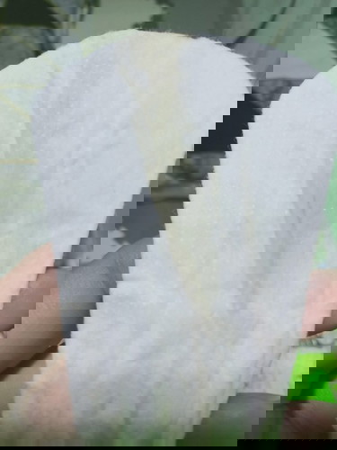 yellow,white discharge na parang green?