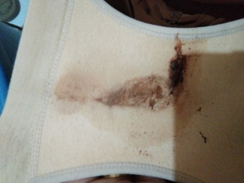 Hello mga mommies Ask ko lang kung normal lang ba na may brown discharge na lumabas saken