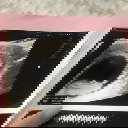 อยากทราบว่าในใบนี้มีตรงไหนแจ้งน้ำหนักกับขนาดของลูกเรามั้ยคะ