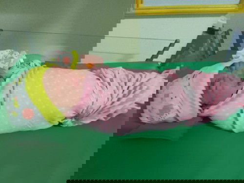 kulit bayi terlihat berubah²