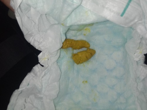 Baby poop