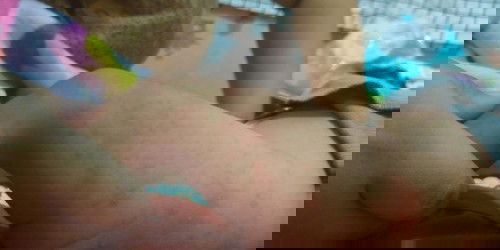 Anakku, ada bintik kuning disampingnya merahmerah ..