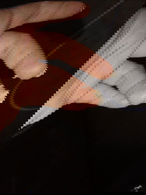 39+2มีมูกขาวขุนใหลออก