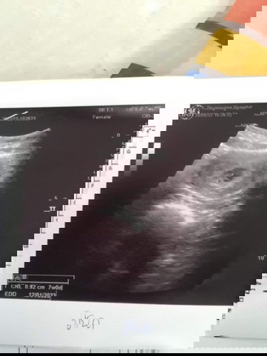7วีคค่ะมีหัวใจแล้ว❤️ขอดูภาพอันเตอร์ซาวด์ของแม่ๆหน่อยค่ะ7วีค #ท้องแรกดีใจมากก รอมา2ปี🥰🥰🥰