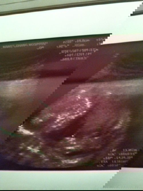 หนูน้อย 17วีคเเล้วนะ หนัก240กรัม
ทีมตุลา