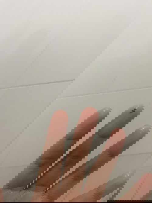 คุณแม่คนไหนเคยมีเลือดออกขณะตั้งครรภ์ไหมคะ