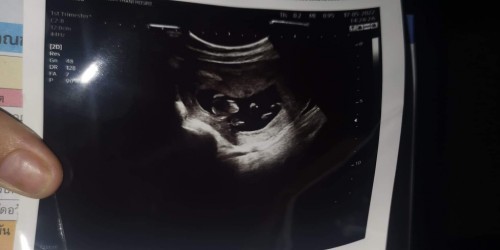 รูปใบอันตร้าซาว