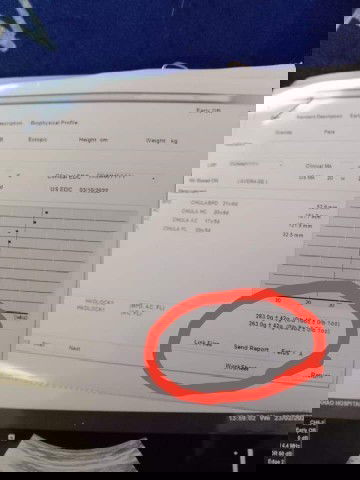 น้ำหนักเด็กในครรภ์