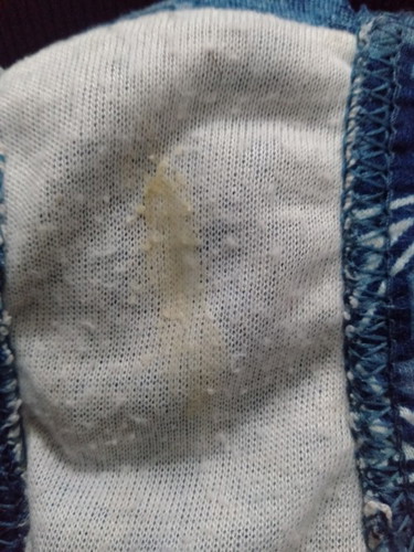 Hi it's normal to have small tummy in 1st trimester and also this is normal discharge??? While pregn