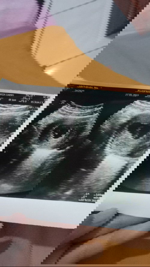 Makanan yg bisa buat penguat kandungan kira kira apa aja ya bund?