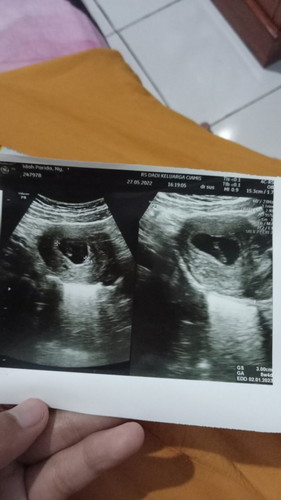 Makanan yg bisa buat penguat kandungan kira kira apa aja ya bund?