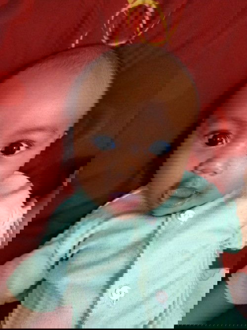 Kepala anak saya ada bandonya katanya Bun.. ? Knp bun