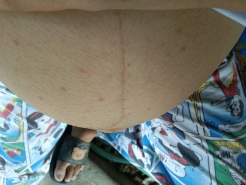 ขอคำปรึกษา และประสบการจากแม่ๆหน่อยจ้า