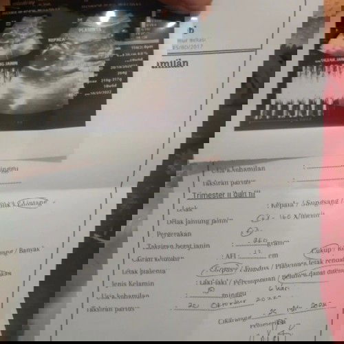 Dihantui rasa kawatir