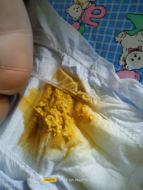 diarrhea concern