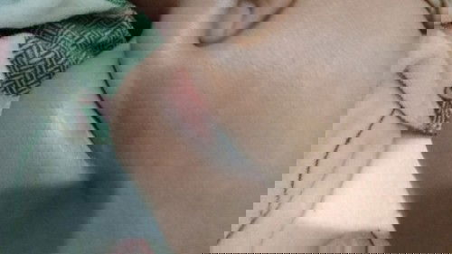 Bantu sering bunda yg pernah ngalamin begini anaknya harus dikasih salep apa biar sembuh