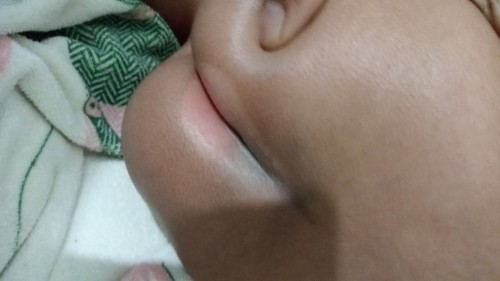 Bantu sering bunda yg pernah ngalamin begini anaknya harus dikasih salep apa biar sembuh