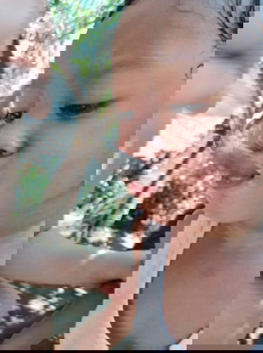 Uneven skin color around neck