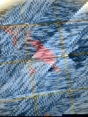 ท้อง6สัปดาห์  มีเลือดออกและมีก้อนเนื้อ