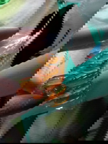 Pag inom ng vitamins.