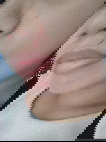 Nasugatan ako ng puppy ko. Im 6 months preggy