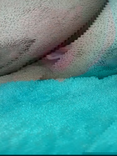 มีแม่ๆคนไหนเจอแผลบนศรีษะน้องแบบนี้ไหมคะ น้องมีรอยแผลแบบนี้ตั้งแต่เกิด ไม่ทราบสาเหตุว่าเกิดจากอะไร