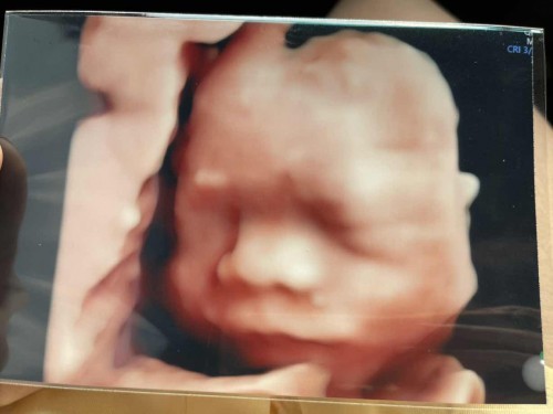 27สัปดาห์1วัน 👶🏻ลูกชาย
