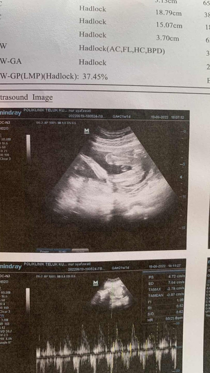 Baby girl or boy?