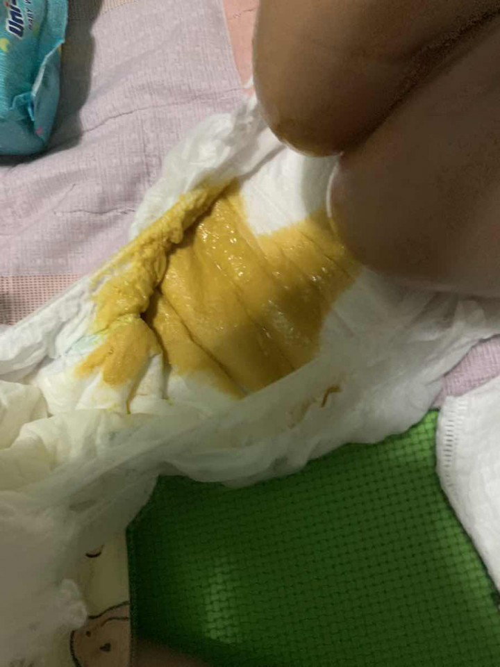 Baby Poop: Runny