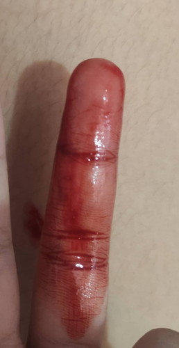 Implantation bleeding ba ito?