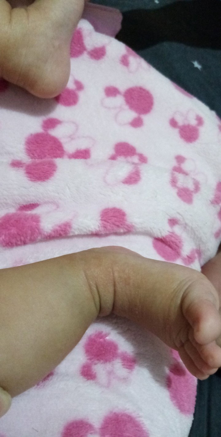 Dry skin 2 months old. Sana mapansin pls