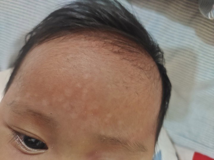 WHITE SPOTS