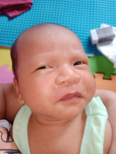baby acne po ba ito o rashes? sabi po kasi ng pedia namin, dahil sa hangin thanks po!!!